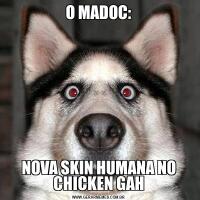 O MADOC:NOVA SKIN HUMANA NO CHICKEN GAH