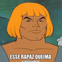 ESSE RAPAZ QUEIMA